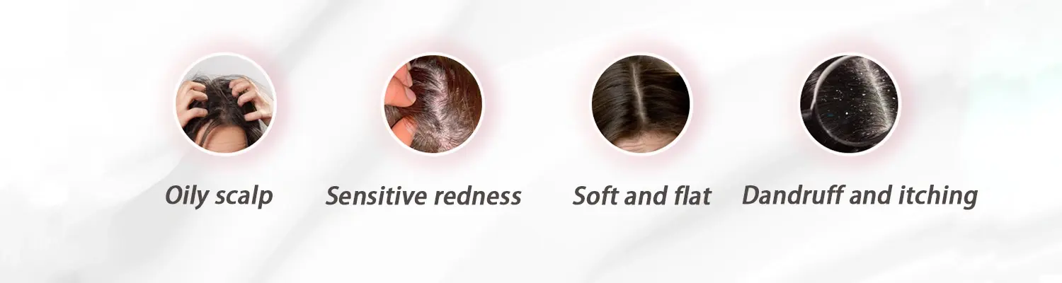 Scalp care foam :1 bottle for a healthy scalp Different problems that can occur with hair